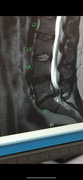A&e, doctors or wait it out?
