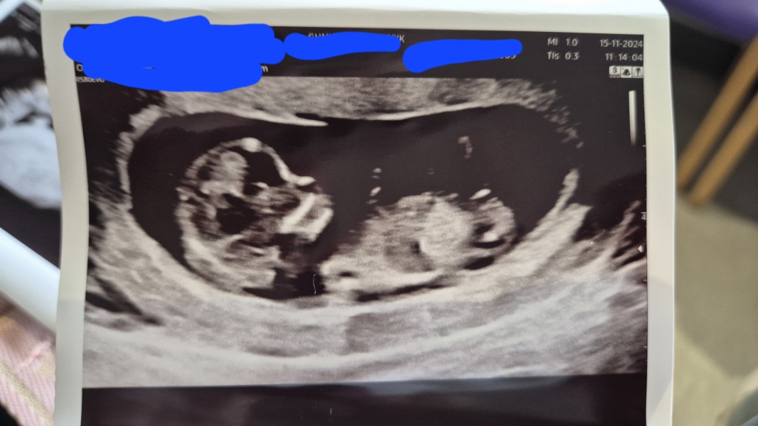Boy or girl?