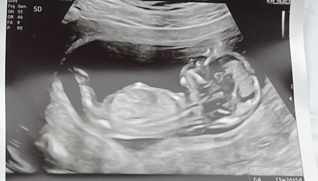 Boy or girl 👶🏼