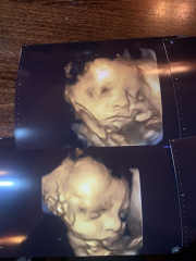 Due February 2025 - Thread 4