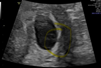 What’s this on my scan?