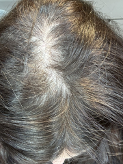 Mounjaro September Support (3)