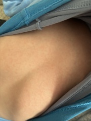 Strep Throat/Scarlet Fever..or just viral illness
