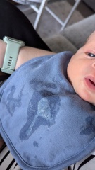 Could this be an allergy? [Content warning: contains pic of contents of nappy]