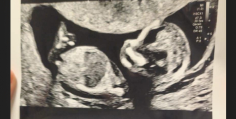 Boy or girl everyone?