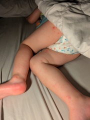 5th dose Calpol in 24hrs?