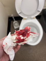 TW- Blood. Had anyone had a similar situation?
