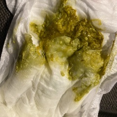 3 month old diarrhoea- Advice please