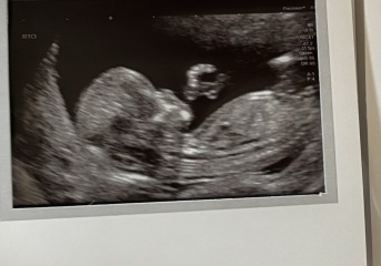 Any guesses girl or boy