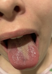 Tongue Photos…!!