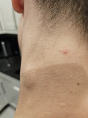 Blood test yesterday