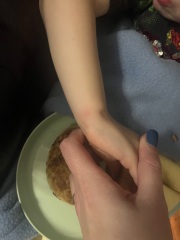 Chicken pox?