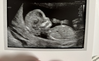 Any guesses girl or boy