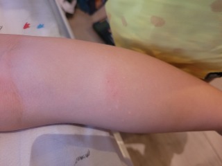Any idea what this might be on DS' leg?