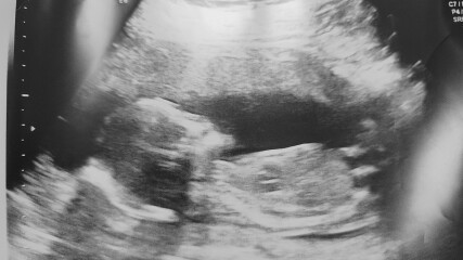 16 week gender guess