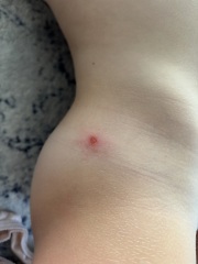 Does anyone know what these marks are?