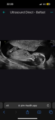Gender Guesses Please