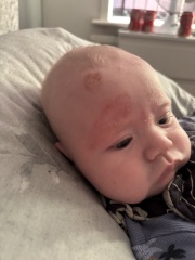 What is this on my sons head???