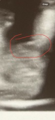 Nub theory