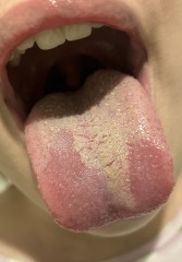 Tongue Photos…!!