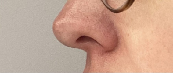 To want to chop off my unsightly nose