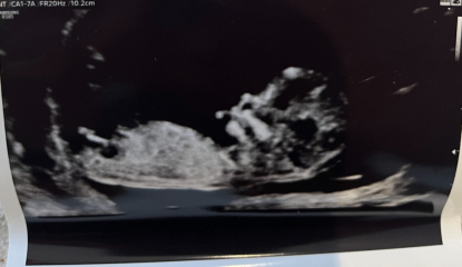 Boy or girl guesses?! Nub  theory!