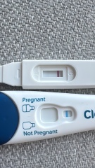 Early pregnancy or indentation lines?