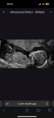 Gender Guesses Please