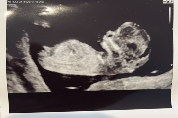 Boy or girl guesses?! Nub  theory!