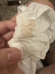 What was your spotting like in early pregnancy?