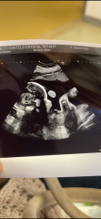 13 weeks and 28 weeks! Gender?