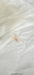 *TMI PIC* what could this bleeding be?