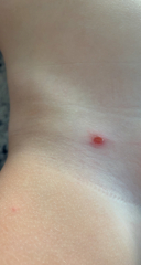 Does anyone know what these marks are?