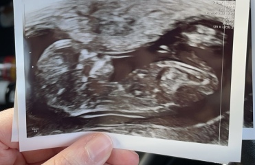 Boy or Girl???