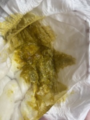 Warning! Poo Pics - is this normal?