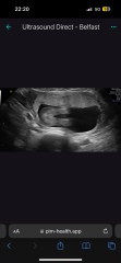 Gender Guesses Please