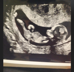 Boy or girl everyone?