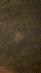 Bald spots on my head