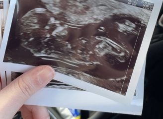 Boy or Girl???