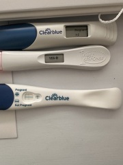 HCG level 34 9DP5DT