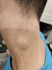 Blood test yesterday