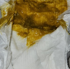 Breast fed Baby Poos WARNING IMAGES ATTACHED ?CMPA