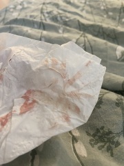 worried about implantation discharge