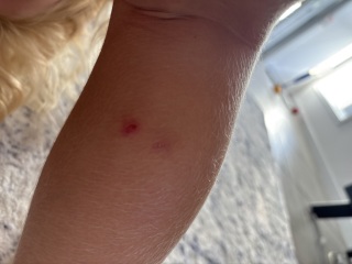 Does anyone know what these marks are?