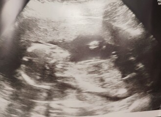 16 week gender guess
