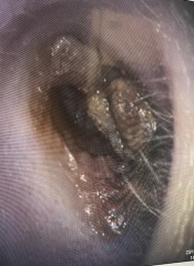 Bought an ear camera PICS