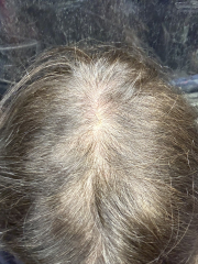 Mounjaro September Support (3)