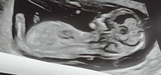 Boy or Girl? 👶🏼