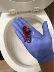 Can someone tell me if this was a miscarriage? :(