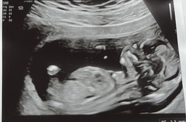 Boy or Girl? 👶🏼